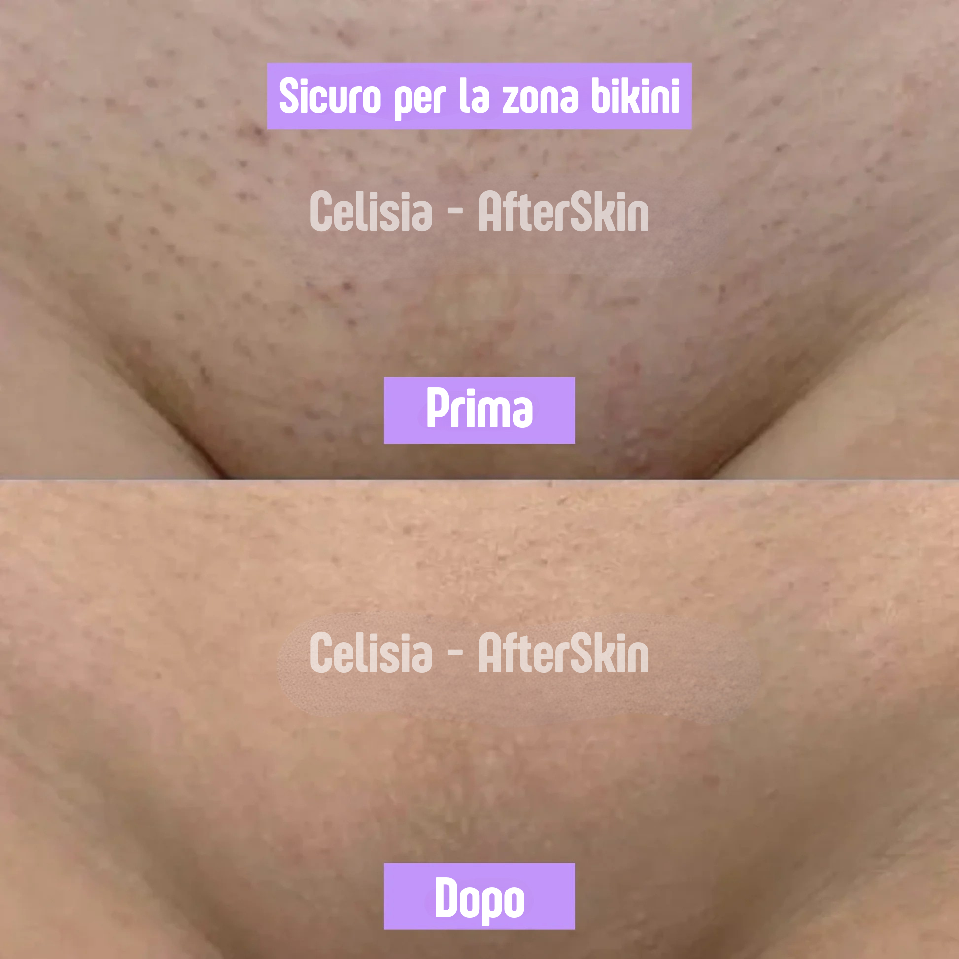 AfterSkin™ – Cyperus Rotundus Skin Serum