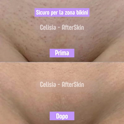 AfterSkin™ – Cyperus Rotundus Skin Serum